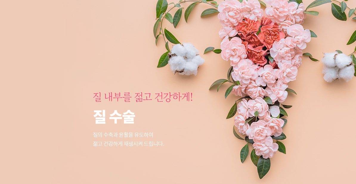 질 수술